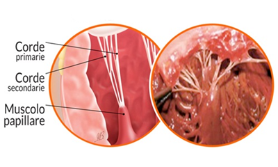 corde-tendinee-e-muscolo-papillare.png